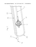 CATHETER PUMP FOR CIRCULATORY SUPPORT diagram and image