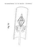 CATHETER PUMP FOR CIRCULATORY SUPPORT diagram and image