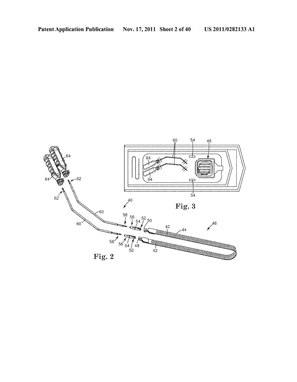 TRANSOBTURATOR SURGICAL ARTICLES AND METHODS - diagram, schematic, and image 03