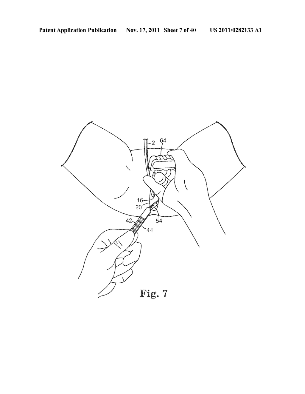 TRANSOBTURATOR SURGICAL ARTICLES AND METHODS - diagram, schematic, and image 08