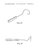 TRANSOBTURATOR SURGICAL ARTICLES AND METHODS diagram and image
