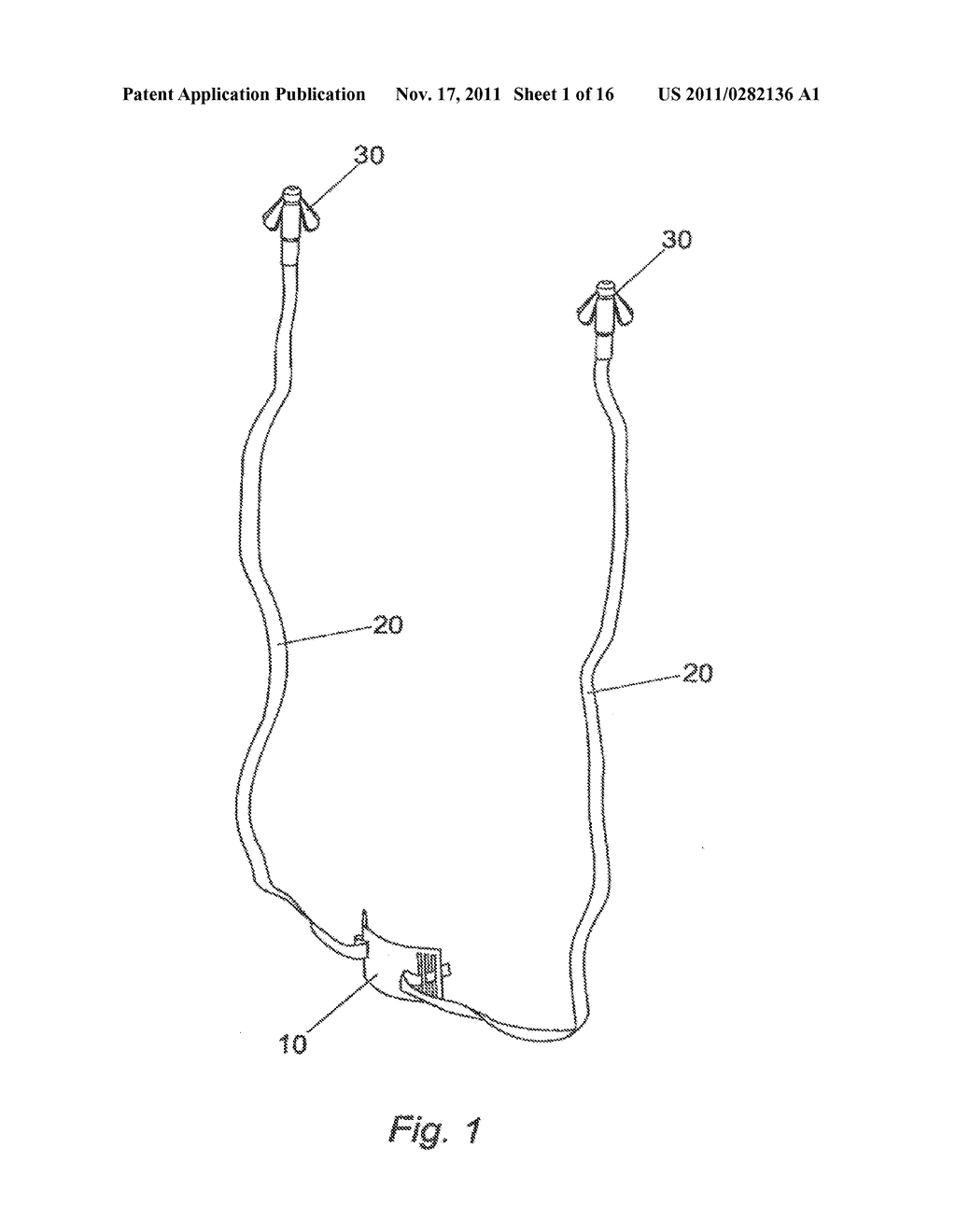 SYSTEM FOR INTRODUCING SOFT TISSUE ANCHORS - diagram, schematic, and image 02