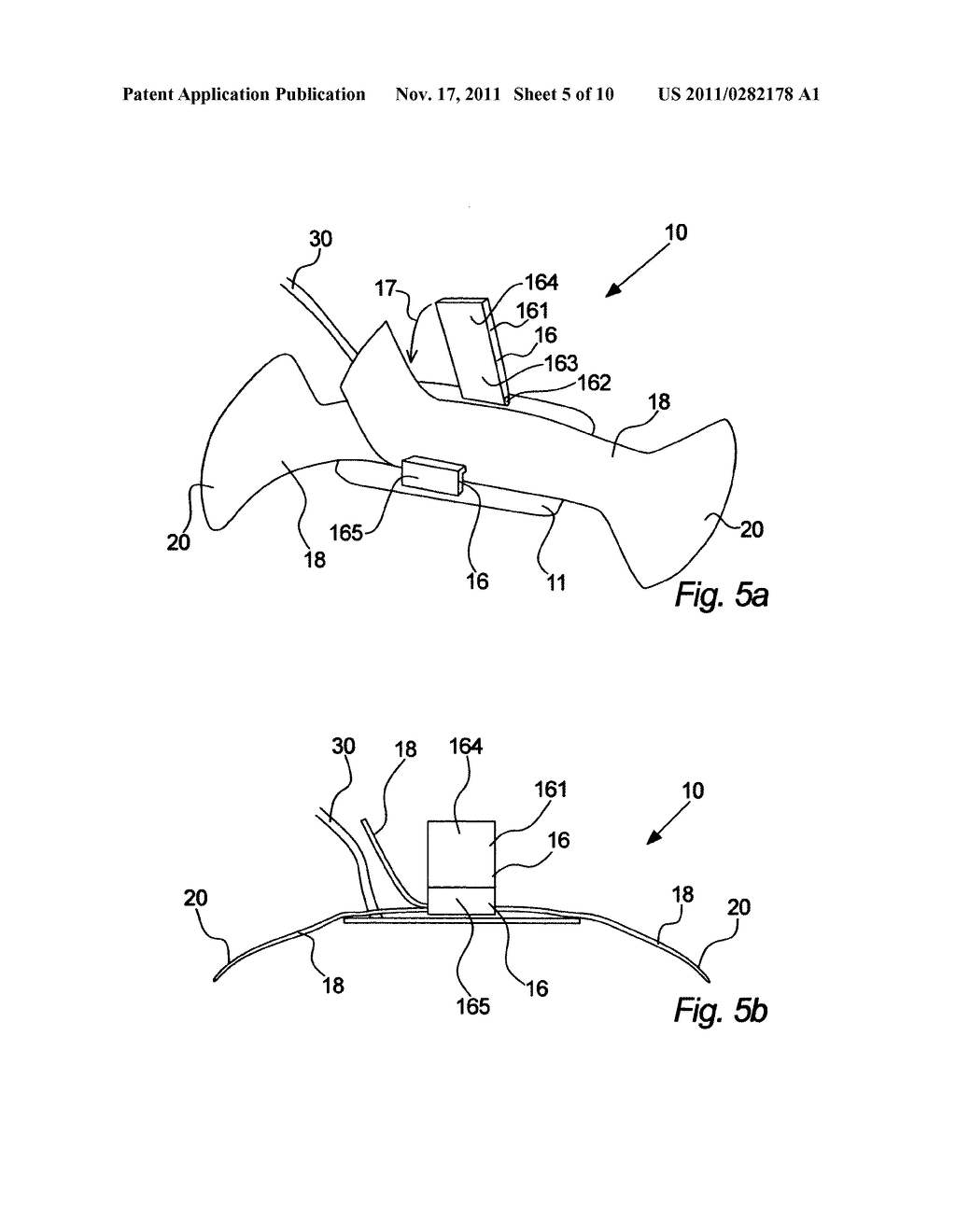 ADHESIVE STRAP FOR FOETAL MONITORING TRANSDUCERS AND THE LIKE - diagram, schematic, and image 06