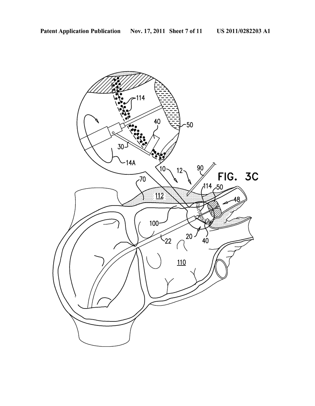 REFLECTANCE-FACILITATED ULTRASOUND TREATMENT AND MONITORING - diagram, schematic, and image 08