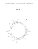 ULTRASONIC DIAGNOSTIC APPARATUS diagram and image