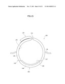 ULTRASONIC DIAGNOSTIC APPARATUS diagram and image