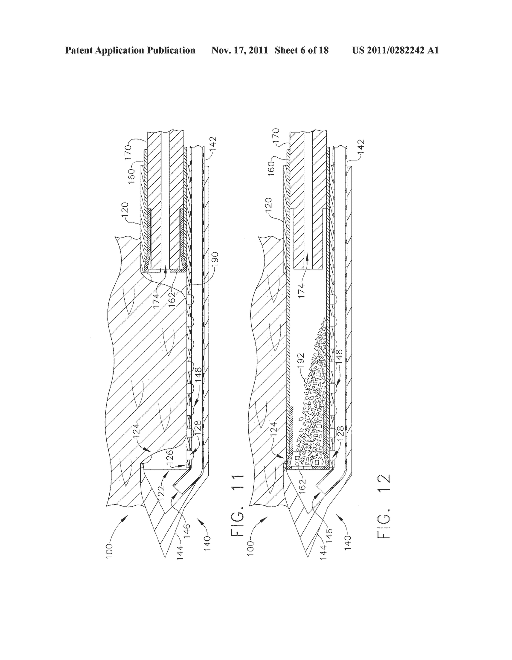 Instrument for Applying Therapeutic Cells, with Proximal Portion for     Processing Therapeutic Cells - diagram, schematic, and image 07