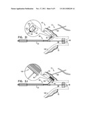 REFLECTANCE-FACILITATED ULTRASOUND TREATMENT diagram and image