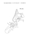 Methods and Systems for Delivery of Acoustic Energy to Tissue Surfaces,     Cavities and Obstructed Passages such as Intranasal Ostia diagram and image