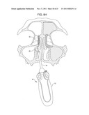 Methods and Systems for Delivery of Acoustic Energy to Tissue Surfaces,     Cavities and Obstructed Passages such as Intranasal Ostia diagram and image