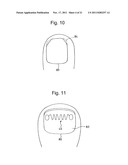 INCURVATED NAIL CORRECTION TOOL diagram and image