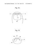 INCURVATED NAIL CORRECTION TOOL diagram and image