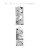 INCURVATED NAIL CORRECTION TOOL diagram and image