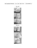 INCURVATED NAIL CORRECTION TOOL diagram and image