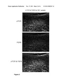 FIBROBLAST GROWTH FACTOR-9 PROMOTES HAIR FOLLICLE REGENERATION AFTER     WOUNDING diagram and image