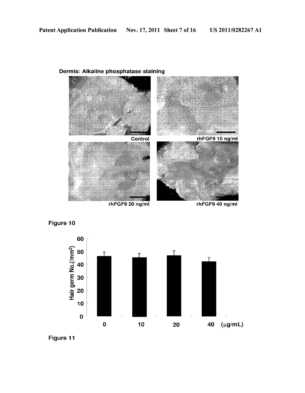 FIBROBLAST GROWTH FACTOR-9 PROMOTES HAIR FOLLICLE REGENERATION AFTER     WOUNDING - diagram, schematic, and image 08