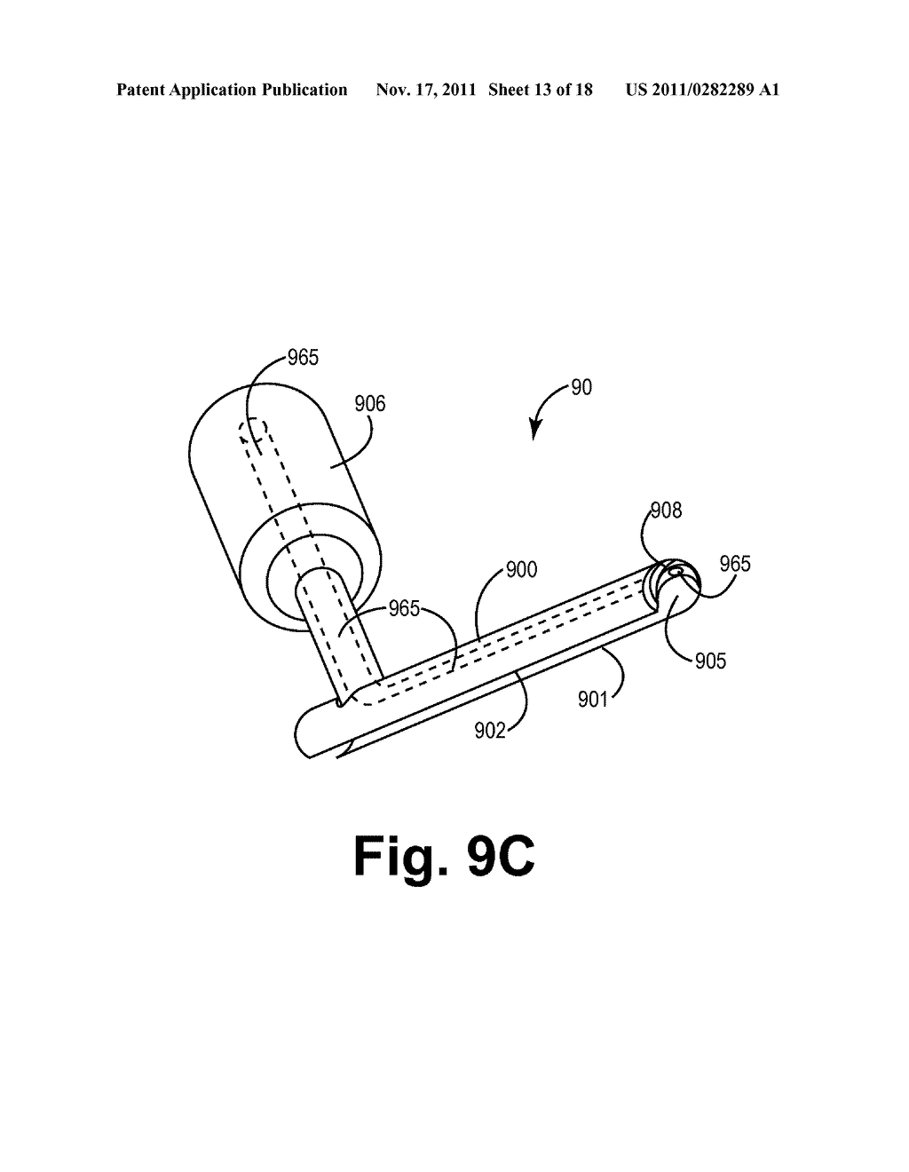 Systems and Methods for Gaining Access Around an Implanted Medical Device - diagram, schematic, and image 14