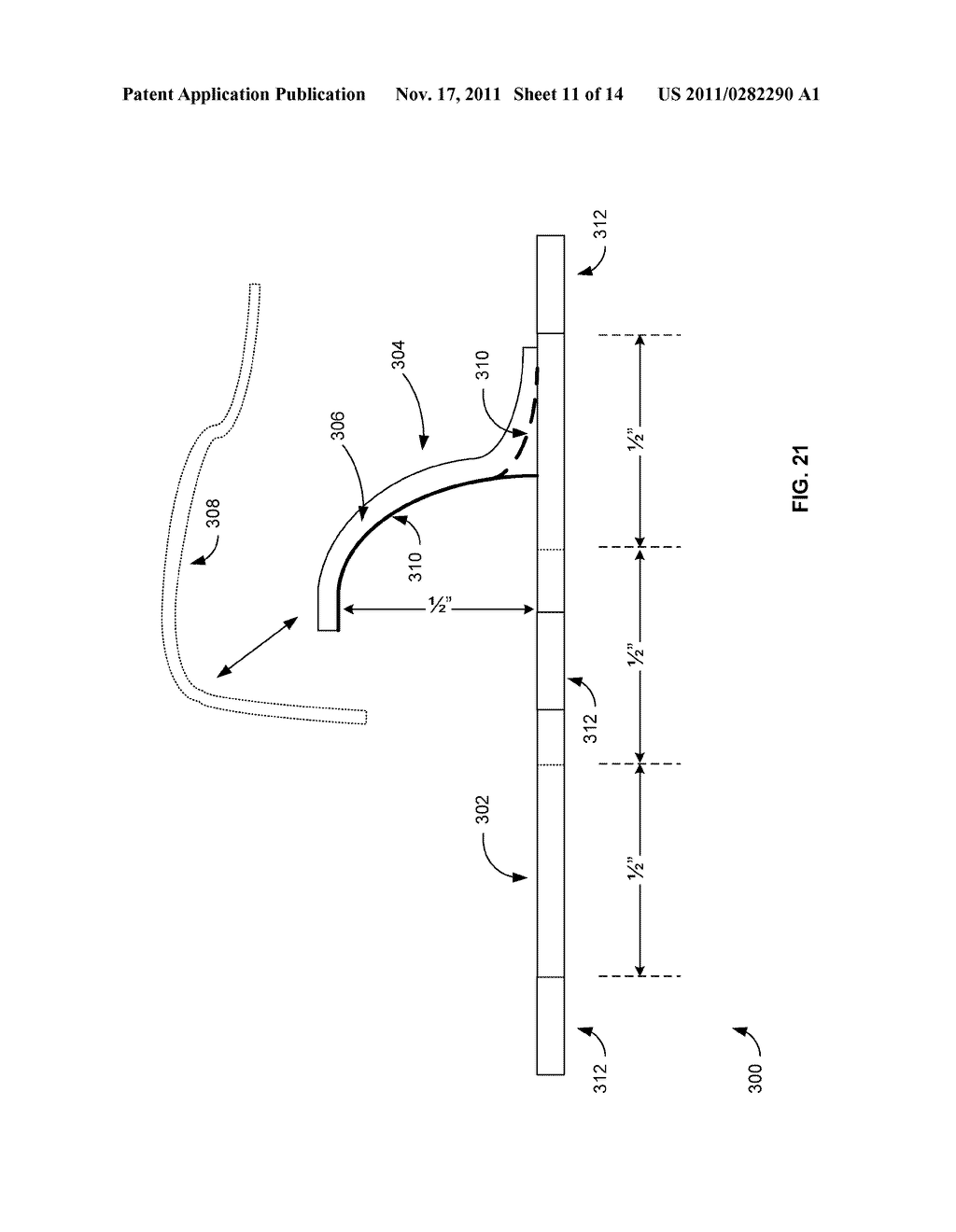 APPARATUS FOR UMBILICAL CATHETER - diagram, schematic, and image 12