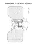 MEDICAL DEVICE SECUREMENT SYSTEM diagram and image