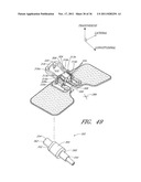 MEDICAL DEVICE SECUREMENT SYSTEM diagram and image