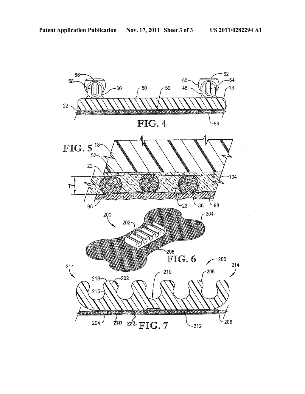 INTRAVENOUS SECUREMENT DEVICE WITH ADHESIVELY INTERCONNECTED ANCHORING     COMPONENT AND PERMEABLE ADHESIVE STRIP - diagram, schematic, and image 04