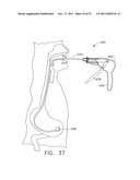 Multi-Chamber Therapeutic Cell Applicator Instrument diagram and image