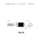 DEVICE AND METHOD FOR FISTULA TREATMENT diagram and image