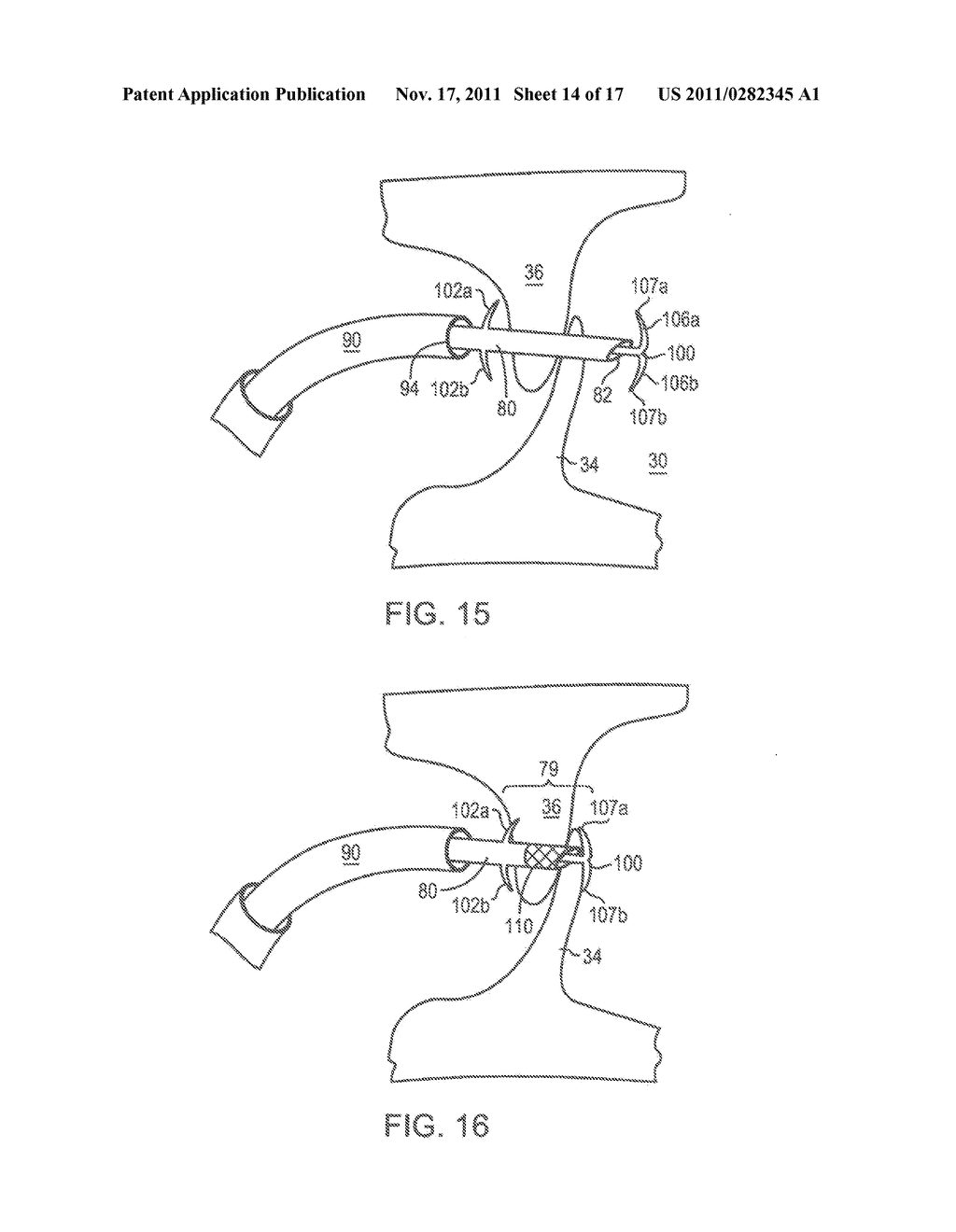 Welding Systems Useful for Closure of Cardiac Openings - diagram, schematic, and image 15