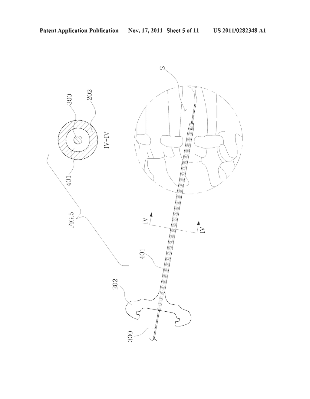 DEVICE FOR FIXATION OF BONE, AND DEVICE SET COMPRISING THE SAME - diagram, schematic, and image 06