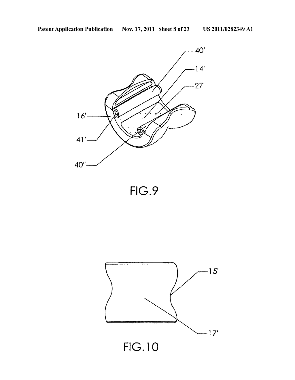 METHODS FOR IMPLANTING A JOINT PROSTHESIS - diagram, schematic, and image 09