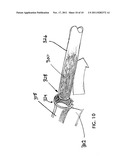 Tissue Dicing and Particle Separation Device diagram and image