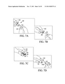 LANCETS AND METHODS OF USE diagram and image