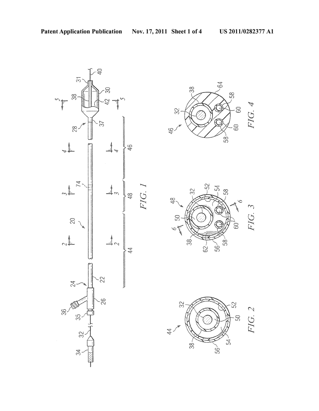 BALLOON DILATION CATHETER HAVING TRANSITION FROM COAXIAL LUMENS TO     NON-COAXIAL MULTIPLE LUMENS - diagram, schematic, and image 02