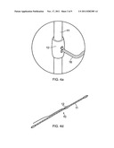 Suture Device diagram and image