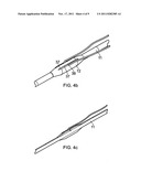 Suture Device diagram and image