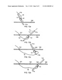 Suture Device diagram and image