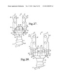 Polyaxial bone screw with cam connection and lock and release insert diagram and image