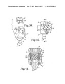 Polyaxial bone screw with cam connection and lock and release insert diagram and image