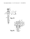 Polyaxial bone screw with cam connection and lock and release insert diagram and image