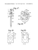 Polyaxial bone screw with cam connection and lock and release insert diagram and image