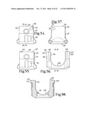 Polyaxial bone screw with cam connection and lock and release insert diagram and image