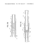 INSTRUMENTS AND METHODS FOR MANIPULATING VERTEBRA diagram and image