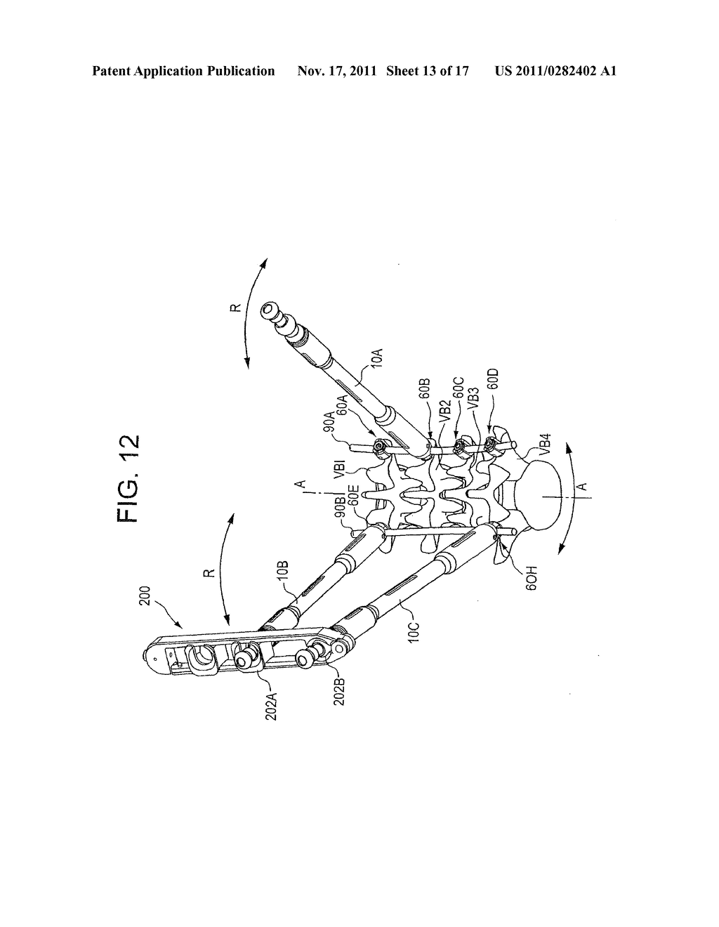 INSTRUMENTS AND METHODS FOR MANIPULATING VERTEBRA - diagram, schematic, and image 14