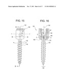 INSTRUMENTS AND METHODS FOR MANIPULATING VERTEBRA diagram and image