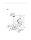 NERVE STIMULATION AND BLOCKING FOR TREATMENT OF GASTROINTESTINAL DISORDERS diagram and image