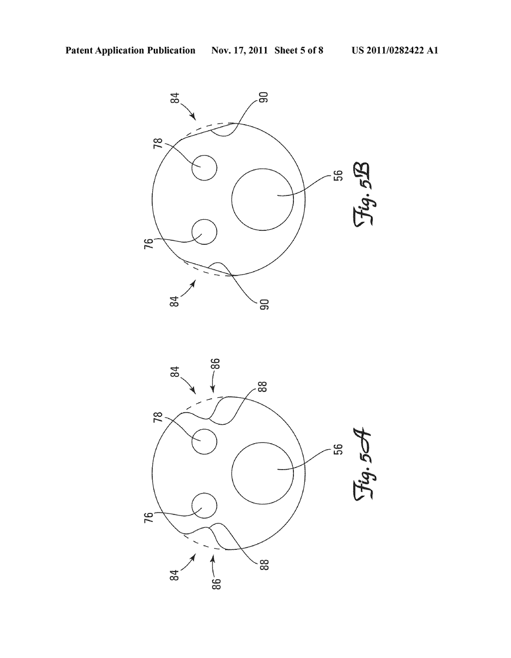 ACTIVE FIXATION LEADS AND METHOD OF ASSEMBLY - diagram, schematic, and image 06