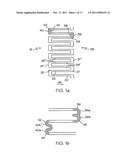 Longitudinally Flexible Expandable Stent diagram and image