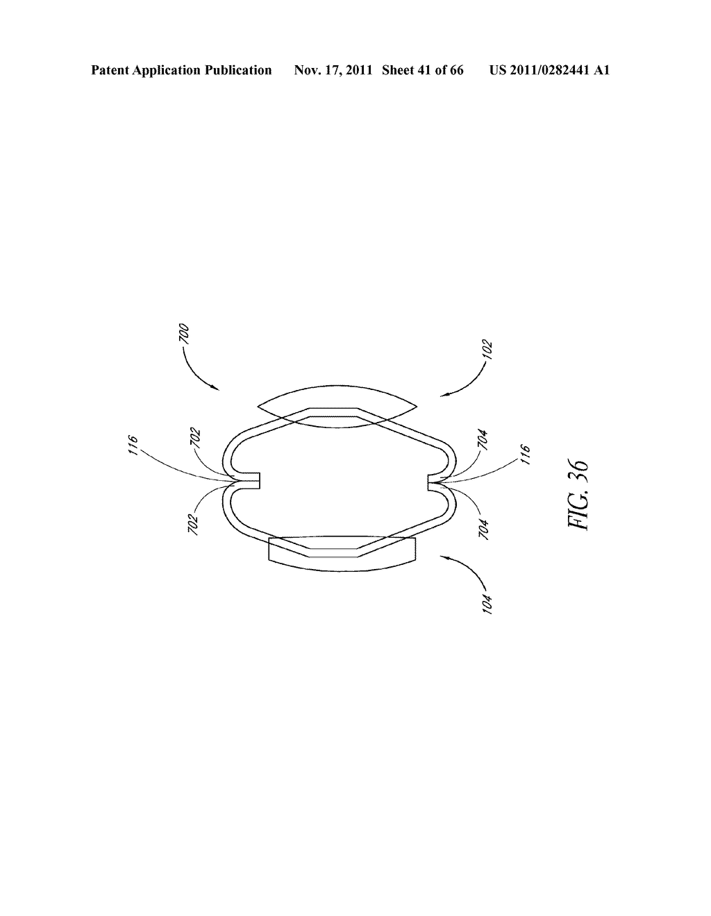 INTRAOCULAR LENS WITH POST-IMPLANTATION ADJUSTMENT CAPABILITIES - diagram, schematic, and image 42