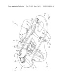 Transport device for ossicular prosthesis diagram and image