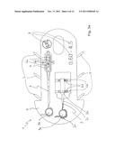 Transport device for ossicular prosthesis diagram and image